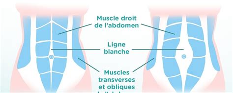 Causes de douleurs au cou que vous ne connaissez peut être pas