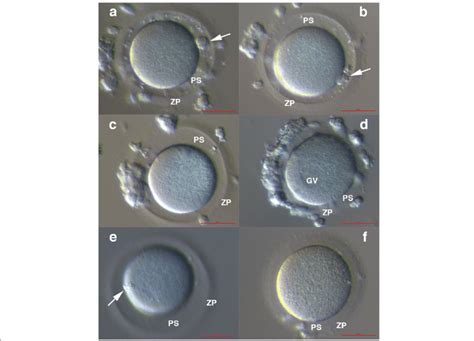 Oocytes After In Vitro Maturation Were Removed From Co Cultured