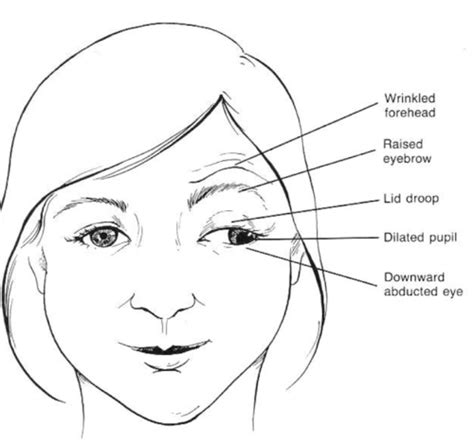 Advanced Optometry: Dilated Fundus Exam Flashcards | Quizlet