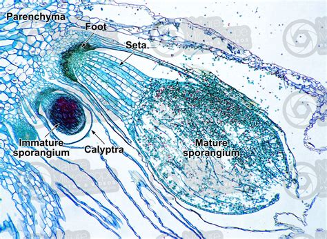 Marchantia polymorpha. Common liverwort. Sporophyte. Longitudinal section. 64X - Sporophyte ...