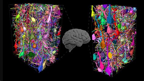 What Makes The Human Brain More Complex Technology Networks