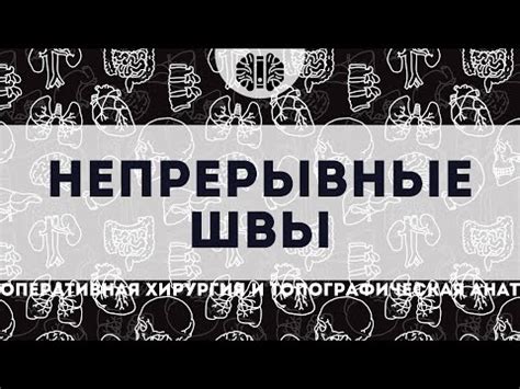 ОХиТА: Непрерывные швы (шов по Ревердену–Мультановскому, обвивной шов ...