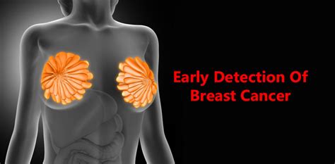 Early Detection Of Breast Cancer Doctor Asky