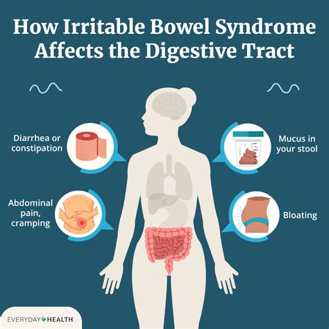 Ibs Bloating