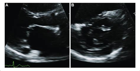 Transthoracic Echocardiography | Download Scientific Diagram