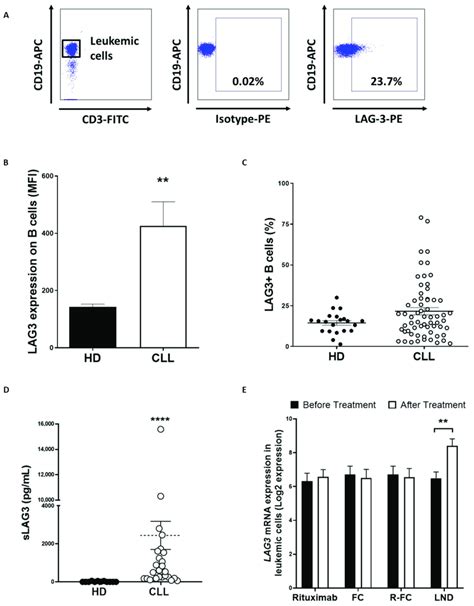 Lag Expression Is Upregulated On Leukemic Cells From Patients With