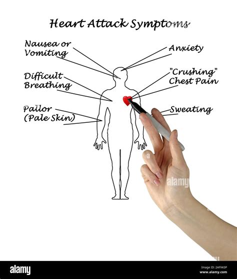 Heart Attack Symptoms Stock Photo - Alamy