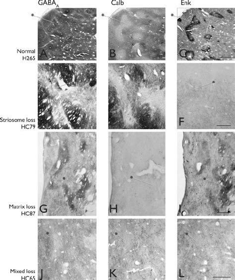 High magnification photomicrographs illustrating the patterns of GABA A ...