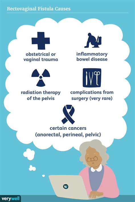 Rectovaginal Fistula Symptoms Causes Diagnosis And Treatment