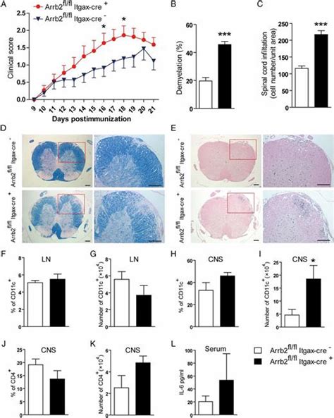 Deficiency Of β Arrestin 2 In Dendritic Cells Contributes To Autoimmune