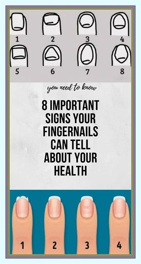 8 Important Signs Your Fingernails Can Tell About Your Health Artofit