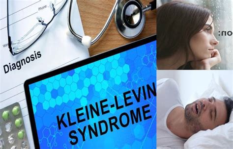 Kleine-Levin Syndrome – Definition, Symptoms, Causes, and More