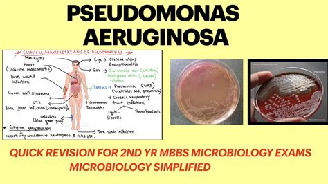 Pseudomonas Aeruginosa Pseudomonas Infection Pseudomonas Lab