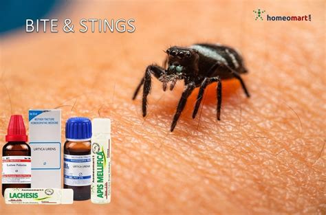 Effective Homeopathic First Aid Treatments For Insect Bites And Stings Homeomart