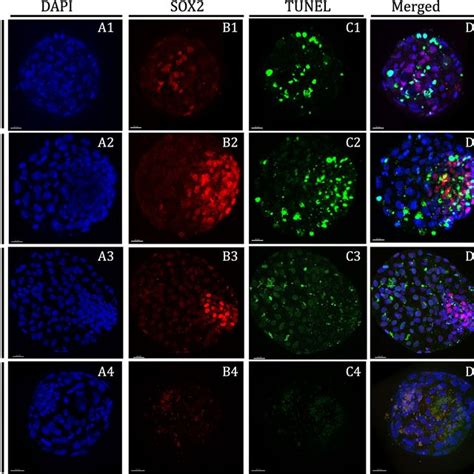 Leukemia Inhibitory Factor Receptor Expression In Endometrial Cells Of