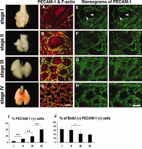 Four Developmental Stages Of The Fetal Lung Vasculature Based On The