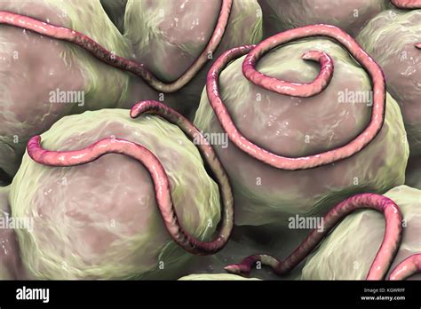 Enterobius Vermicularis Fotografías E Imágenes De Alta Resolución Alamy