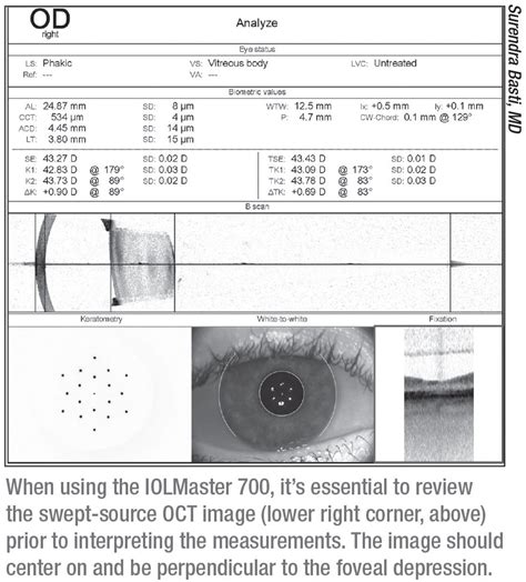 Biometry And Formulas Nailing The Outcome