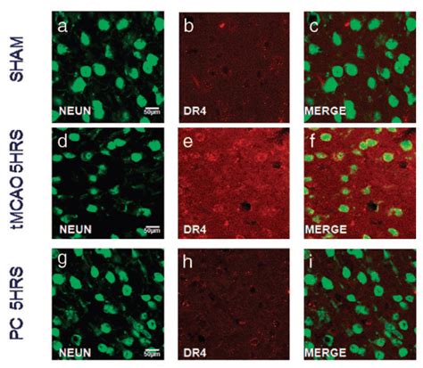 Anti Dr Nt Antibody Qed Bioscience Inc