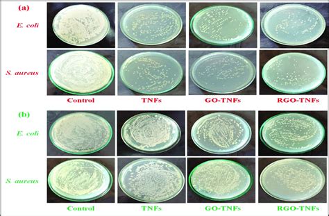 Bacterial Colonies Of E Coli And S Aureus Grown On An Agar Plate