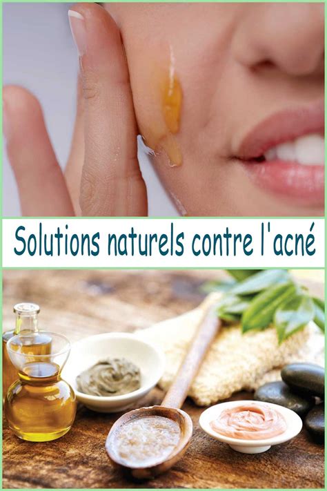 Solutions Naturels Contre L Acn Sports Et Sant