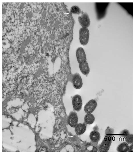 Microorganisms Free Full Text Intimate Attachment Of Escherichia