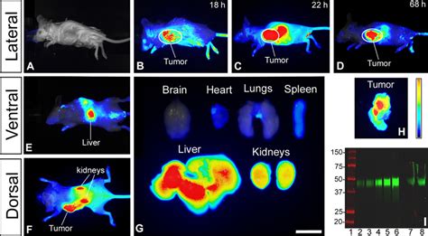 Ir Labeled Decorin Protein Core Targets Specifically The Human Tumor