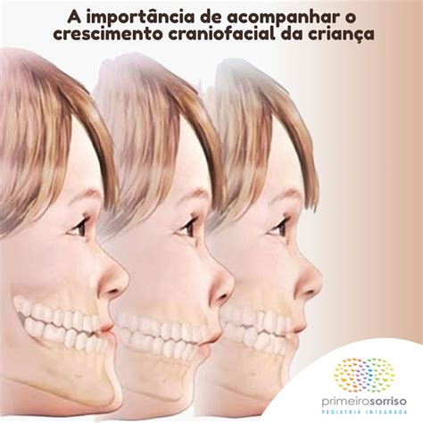 Crescimento E Desenvolvimento Craniofacial Librain