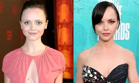 Christina Ricci Nose Job Plastic Surgery Before and After | Celebie