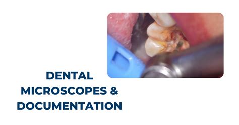 Dental Microscopes Documentation Getting The Most From Your Scope