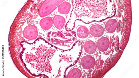 Ascaris lumbricoides under microscope. Haematoxylin end eosin stain ...