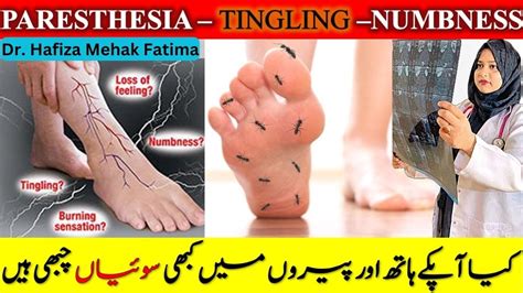 What Causes Pins And Needles Paresthesia Sensation Hath Or Pairon Me Soiyan Chubhne Ki Waja