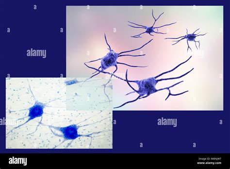 Nerve Cells Computer Illustration And Light Micrograph Of Nerve Cells