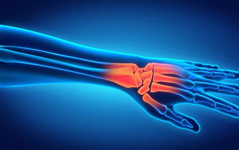 complex hand reconstruction overview procedures recovery ifar