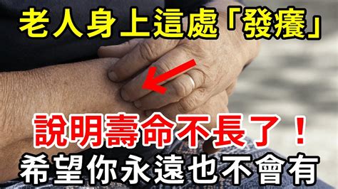 老人55歲後，若身上這處「發癢」，說明壽命已經不多了！一個不佔的人要恭喜了，活到100歲都沒問題【中老年講堂】 Youtube