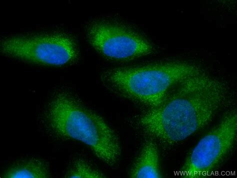 Galectin Monoclonal Antibody G D Coralite Proteintech