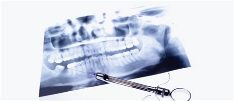 Complications in Local Anesthesia - Dimensions of Dental Hygiene