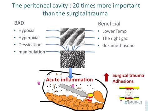 Prevention of postoperative adhesions - gynsurgery.org