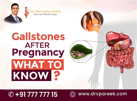 Gallstones after pregnancy: What to know?