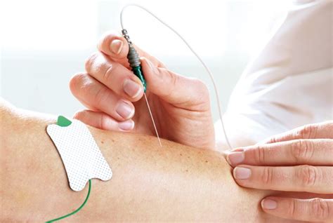 Emg Onderzoek Electromyografie Neurologie