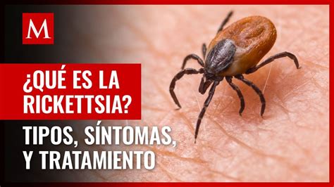 Qué es la rickettsia cómo se contagia y cuáles son los síntomas