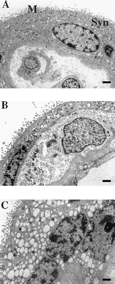 Electron Micrograph Of The Placental Villi Sampled A At 0 H B