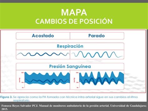 Monitoreo Ambulatorio De Presi N Arterial Mapa Ppt