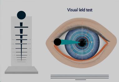 Comprendre L examen du Champ Visuel en 4 étapes