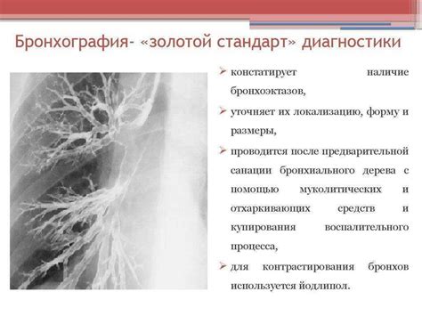 Бронхография - суть метода исследования. подготовка к бронхографии ...