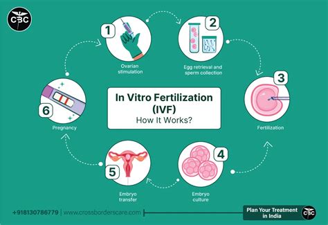 Ivf In Vitro Fertilization Procedure And How It Works