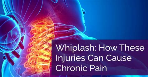 Whiplash How These Injuries Can Cause Chronic Pain Asheville Nc