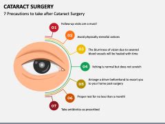 Cataract Surgery PowerPoint And Google Slides Template PPT Slides