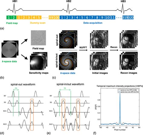 Dynamic Cardiac Mri With High Spatiotemporal Resolution Using