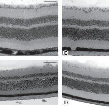 Photomicrographs Of H E Stained Retinal Cryosections 10 Weeks